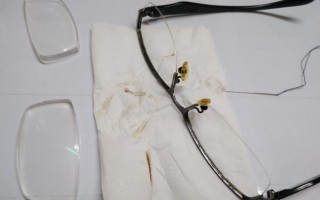 眼镜上镀膜磨损怎么办，眼镜上镀膜磨损怎么办呢