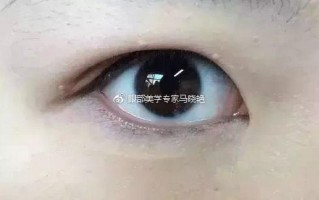 单眼皮戴什么眼睛框好看，单眼皮好看还是双眼皮好看