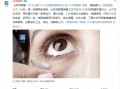 带美瞳眨眼睛怎么办，戴美瞳后眼睛模糊怎么办